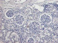 AIFM1 (aa183-195) Antibody