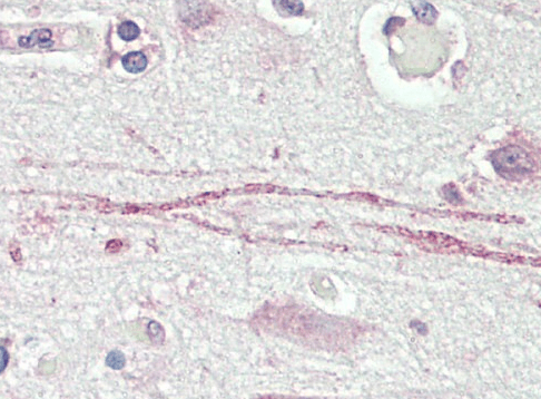 ASIC1 Antibody