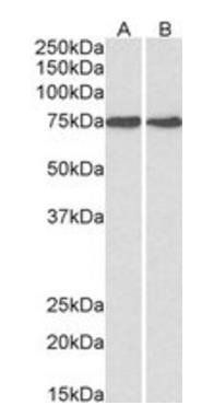 HSPA5/GRP78 Antibody