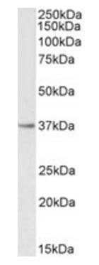 Goat anti-PTGR1 Antibody