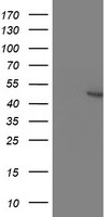 MAPRE2 Antibody