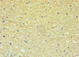ECE2 Antibody