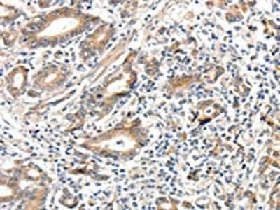ECE2 Antibody