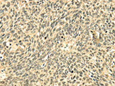 ECE2 Antibody
