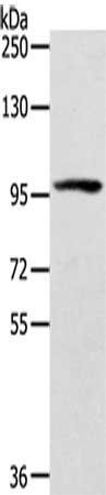 ECE2 Antibody