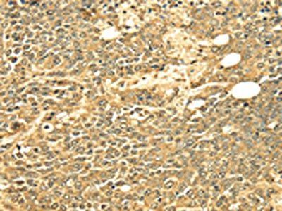 ECE2 Antibody