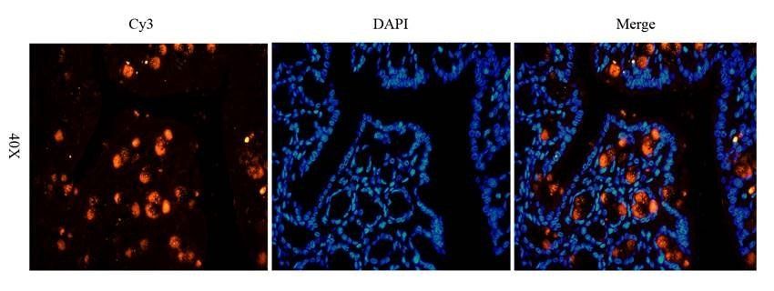 ECP Rabbit Polyclonal Antibody