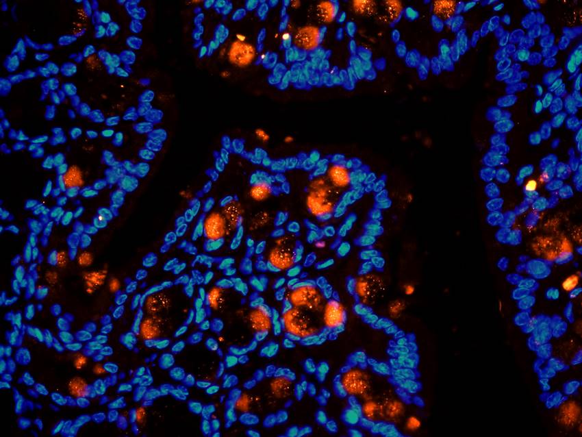 ECP Rabbit Polyclonal Antibody