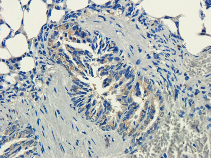 ECP Rabbit Polyclonal Antibody