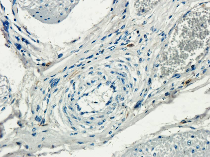 ECP Rabbit Polyclonal Antibody