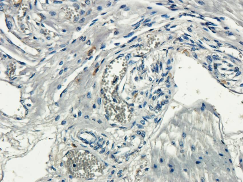ECP Rabbit Polyclonal Antibody