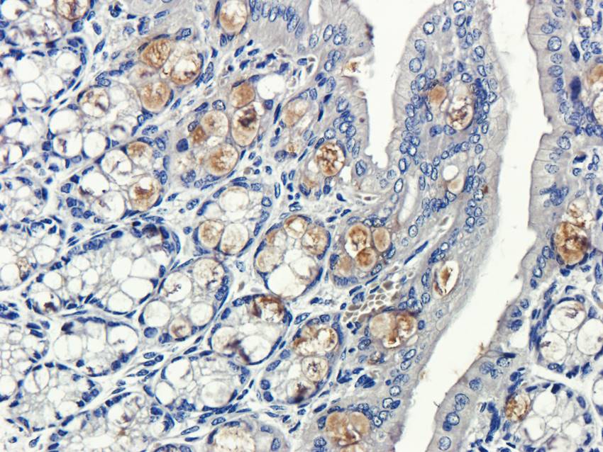 ECP Rabbit Polyclonal Antibody
