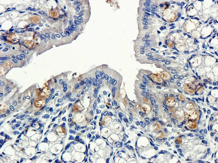 ECP Rabbit Polyclonal Antibody