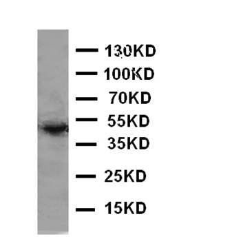Ectodysplasin-A EDA Rabbit Polyclonal Antibody