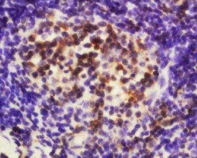 EDG6 Rabbit Polyclonal Antibody