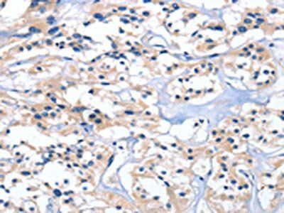 EDN3 Antibody