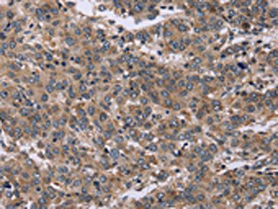 EDN3 Antibody