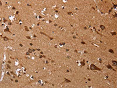 EDN3 Antibody