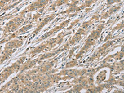 EEF2 Antibody