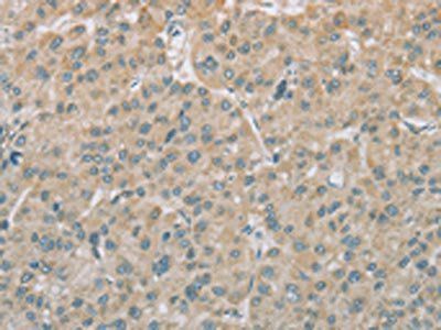 EEF2 Antibody