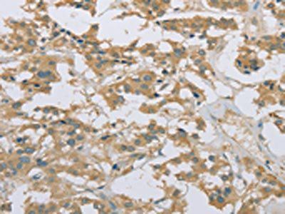 EEF2 Antibody