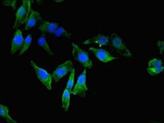 EEF2K Antibody