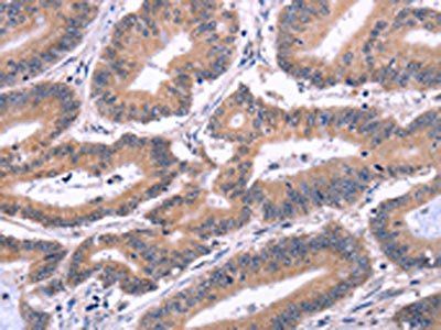 EFNA5 Antibody