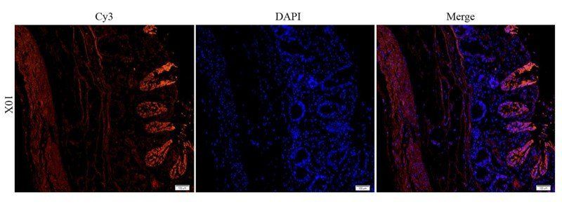 EGFR isoform a variant antibody