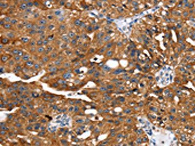 EGLN1 Antibody