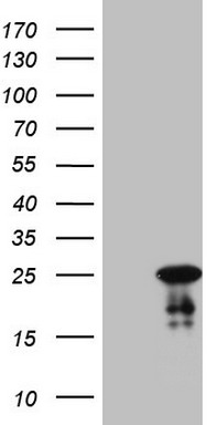 EIF1AY Antibody