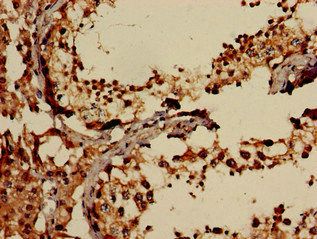 EIF2AK1 Antibody
