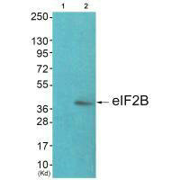 EIF2S2 Antibody