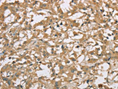 EIF3F Antibody
