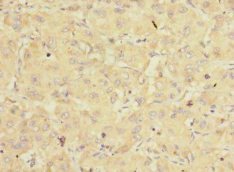 EIF3K Antibody