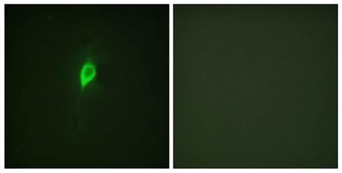 eIF4B (Phospho-Ser422) Antibody