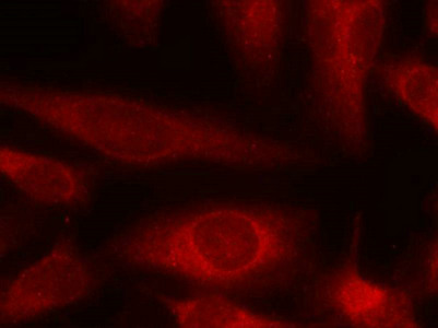 EIF4EBP1 (Ab-45) Antibody