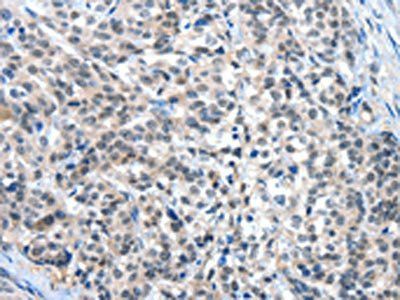 EIF4EBP1 Antibody