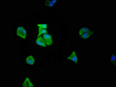 EIF5A Antibody