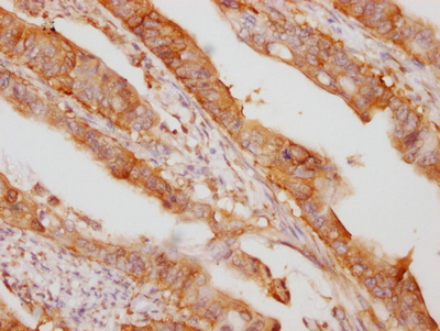 EIF5A Antibody