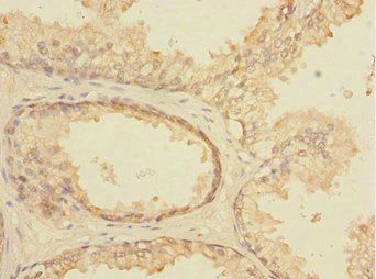 ELF5 Antibody