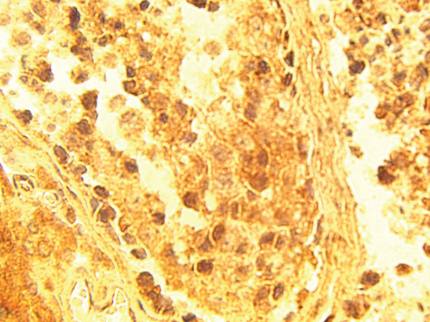 Rabbit Human ELOVL4 Antibody