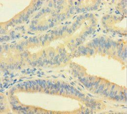 EME1 Antibody