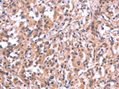 EMP2 Antibody
