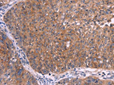 EMP2 Antibody