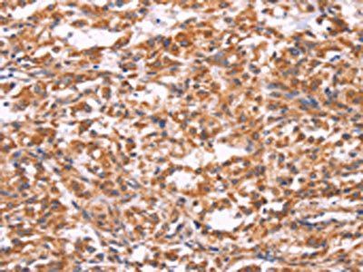 EMP2 Antibody