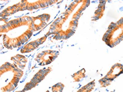 SCNN1A Antibody