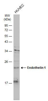 Endothelin 1 Rabbit Polyclonal Antibody