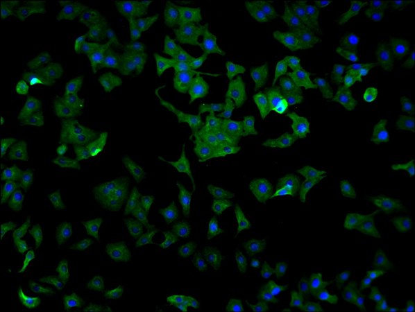 ENO1 Monoclonal Antibody