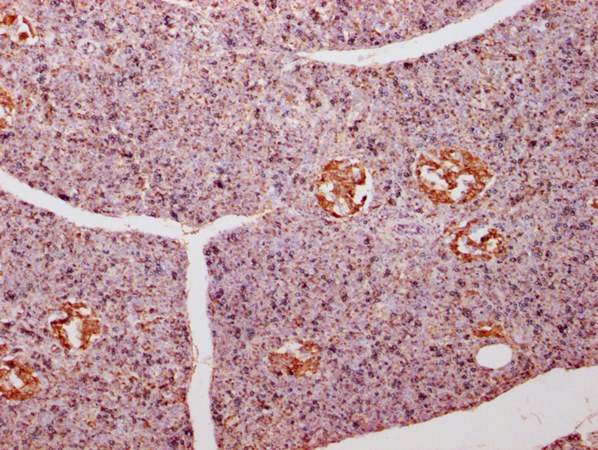 ENO1 Monoclonal Antibody
