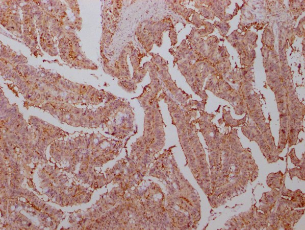 ENO1 Monoclonal Antibody